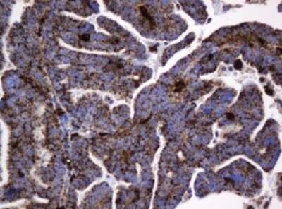 Immunohistochemistry: beta-Galactosidase-1/GLB1 Antibody (OTI1C9) [NBP2-45731]