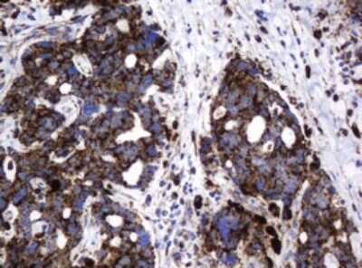 Immunohistochemistry: beta-Galactosidase-1/GLB1 Antibody (OTI1C9) [NBP2-45731]