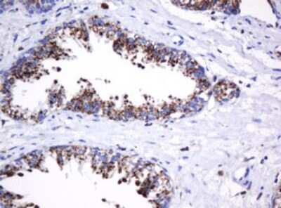 Immunohistochemistry: beta-Galactosidase-1/GLB1 Antibody (OTI1C9) [NBP2-45731]