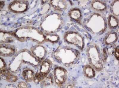 Immunohistochemistry: beta-Galactosidase-1/GLB1 Antibody (OTI1C9) [NBP2-45731]