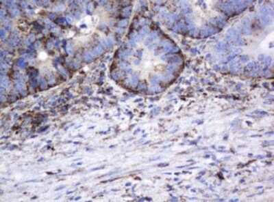 Immunohistochemistry: beta-Galactosidase-1/GLB1 Antibody (OTI1C9) [NBP2-45731]