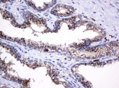 Immunohistochemistry: beta-Galactosidase-1/GLB1 Antibody (OTI1C9) [NBP2-45731]