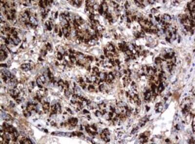 Immunohistochemistry: beta-Galactosidase-1/GLB1 Antibody (OTI1C9) [NBP2-45731]