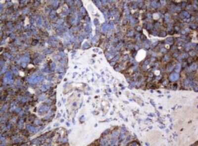 Immunohistochemistry: beta-Galactosidase-1/GLB1 Antibody (OTI1C9) [NBP2-45731]