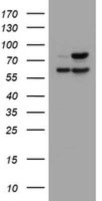 Western Blot: beta-Galactosidase-1/GLB1 Antibody (OTI1C9) [NBP2-45731]