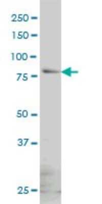 Western Blot: beta-Galactosidase-1/GLB1 Antibody (6E7) [H00002720-M01]