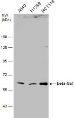 Western Blot: beta-Galactosidase-1/GLB1 Antibody [NBP1-32018]