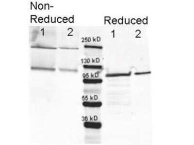 Western Blot: beta Galactosidase Antibody [NB600-305]