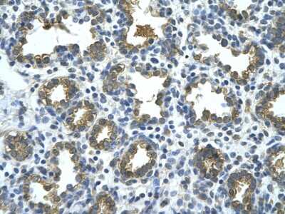 Immunohistochemistry: beta-Glucuronidase/GUSB Antibody [NBP1-69355]