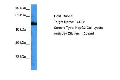 Western Blot: beta I + II Tubulin Antibody [NBP2-83946]