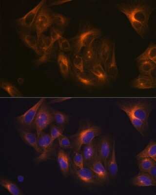 Immunocytochemistry/ Immunofluorescence: beta I Tubulin Antibody (2Z6P1) [NBP3-15928]