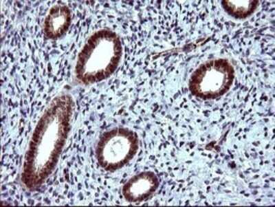 Immunohistochemistry: beta I Tubulin Antibody (OTI4A3) - Azide and BSA Free [NBP2-72225]