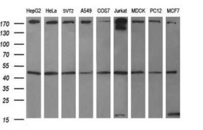 Western Blot: beta I Tubulin Antibody (OTI4A3)Azide and BSA Free [NBP2-72225]