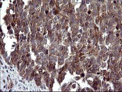 Immunohistochemistry: beta I Tubulin Antibody (OTI4A3) [NBP2-46245]