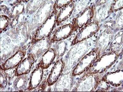 Immunohistochemistry: beta I Tubulin Antibody (OTI4A3) [NBP2-46245]