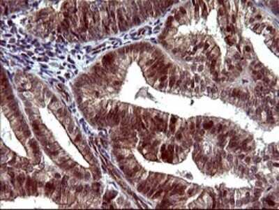 Immunohistochemistry: beta I Tubulin Antibody (OTI4A3) [NBP2-46245]
