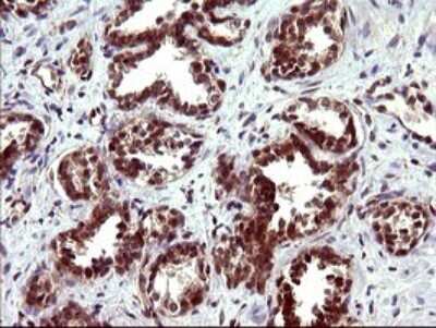 Immunohistochemistry: beta I Tubulin Antibody (OTI4A3) [NBP2-46245]