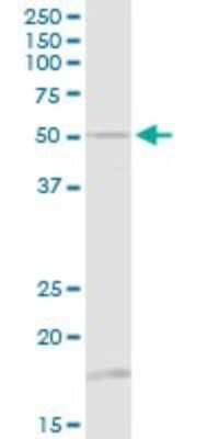 Western Blot: beta I Tubulin Antibody [H00081027-D01P]