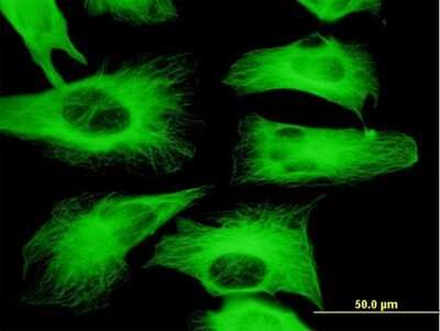 Immunocytochemistry/ Immunofluorescence: beta II Tubulin A Antibody (3B2) [H00007280-M04]