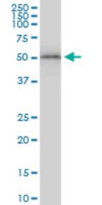 Western Blot: beta II Tubulin A Antibody (3B2) [H00007280-M04]