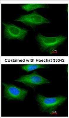Immunocytochemistry/ Immunofluorescence: beta II Tubulin A Antibody [NBP2-15580]