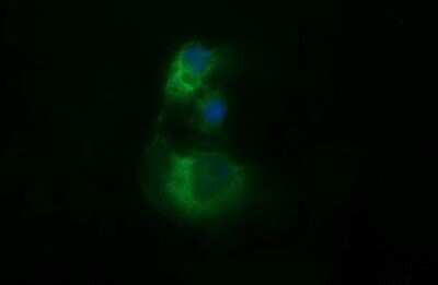 Immunocytochemistry/ Immunofluorescence: beta II Tubulin B Antibody (OTI6D11) - Azide and BSA Free [NBP2-72505]
