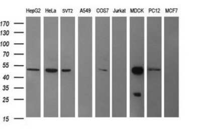 Western Blot: beta II Tubulin B Antibody (OTI6D11)Azide and BSA Free [NBP2-72505]