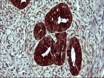 Immunohistochemistry: beta II Tubulin B Antibody (OTI6D11) [NBP2-46250]