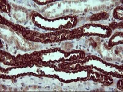 Immunohistochemistry: beta II Tubulin B Antibody (OTI6D11) [NBP2-46250]