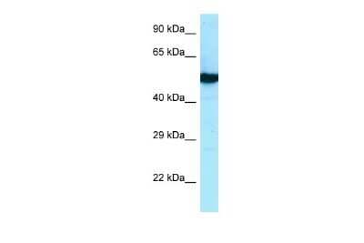 Western Blot: beta II Tubulin B Antibody [NBP2-88773]