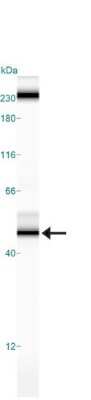 Simple Western: beta-III Tubulin Antibody (2E9) [NBP1-42568]