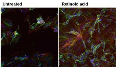 Immunocytochemistry/ Immunofluorescence: beta-III Tubulin Antibody (2G10) [NBP2-37816]
