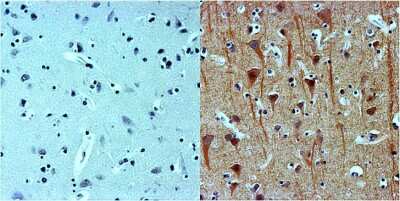 Immunohistochemistry: beta-III Tubulin Antibody (2G10) [NBP2-37816]