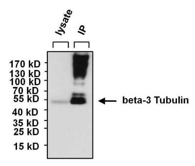 Immunoprecipitation: beta-III Tubulin Antibody (2G10) [NBP2-37816]