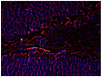 Immunohistochemistry: beta-III Tubulin Antibody (AA10) [NBP1-30048]