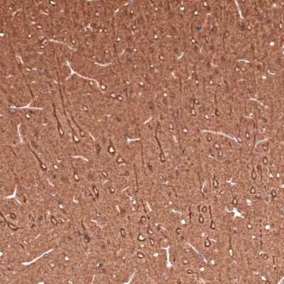 Immunohistochemistry-Paraffin: beta-III Tubulin Antibody (CL5813) [NBP2-61430]