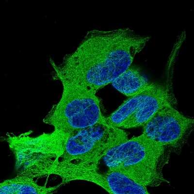 Immunocytochemistry/ Immunofluorescence: beta-III Tubulin Antibody (CL5814) [NBP2-61431]