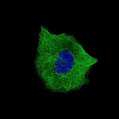 Immunocytochemistry/ Immunofluorescence: beta-III Tubulin Antibody (CL5814) [NBP2-61431]