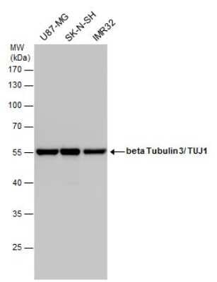 Western Blot: beta-III Tubulin Antibody (GT1338) [NBP3-13505]