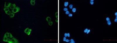 Immunocytochemistry/ Immunofluorescence: beta-III Tubulin Antibody (S02-4G7) [NBP3-19582]