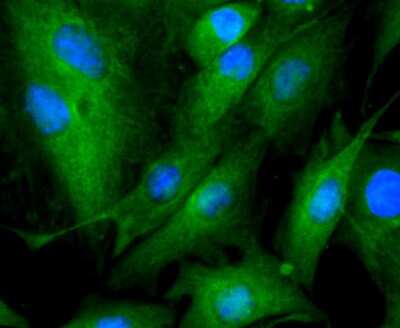 Immunocytochemistry/ Immunofluorescence: beta-III Tubulin Antibody (SP06-00) [NBP2-67374]