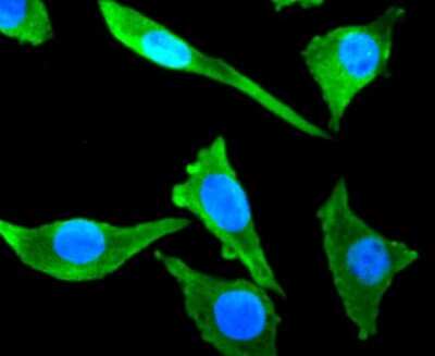 Immunocytochemistry/ Immunofluorescence: beta-III Tubulin Antibody (SP06-00) [NBP2-67374]