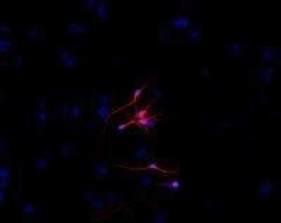 Immunocytochemistry/ Immunofluorescence: beta-III Tubulin Antibody (TU-20) - BSA Free [NB600-1018]