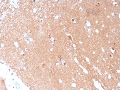 Immunohistochemistry-Paraffin: beta-III Tubulin Antibody (TUBB3/3731) - Azide and BSA Free [NBP3-08439]