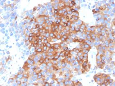 Immunohistochemistry-Paraffin: beta-III Tubulin Antibody (TUBB3/3732) [NBP3-07386]