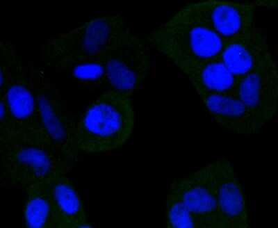 Immunocytochemistry/ Immunofluorescence: beta-NGF Antibody (SI79-01) [NBP2-67406]