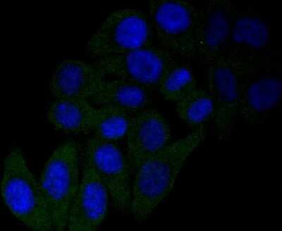 Immunocytochemistry/ Immunofluorescence: beta-NGF Antibody (SI79-01) [NBP2-67406]