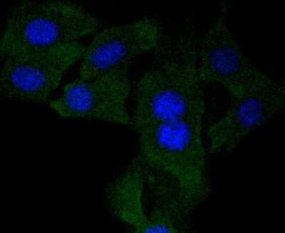 Immunocytochemistry/ Immunofluorescence: beta-NGF Antibody (SI79-01) [NBP2-67406]