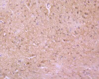 Immunohistochemistry-Paraffin: beta-NGF Antibody (SI79-01) [NBP2-67406]
