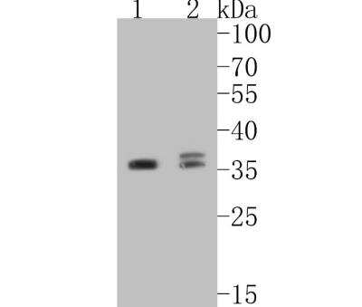 Western Blot: beta-NGF Antibody (SI79-01) [NBP2-67406]